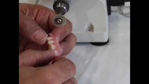 TCS Quick Tip 14 - Finishing A Flexible Partial Part 6