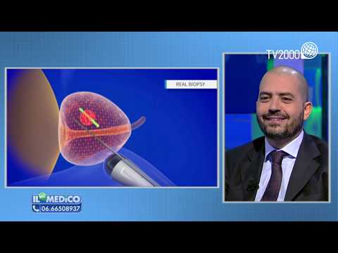 Video: Periuretrale è una parola?