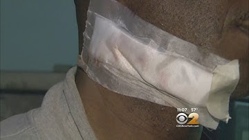 Man Slashed At Brooklyn Subway Stop