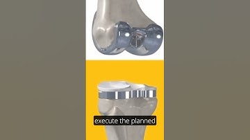 Robot-Assisted Hip and Knee Replacement Surgery #kneepain #hippain