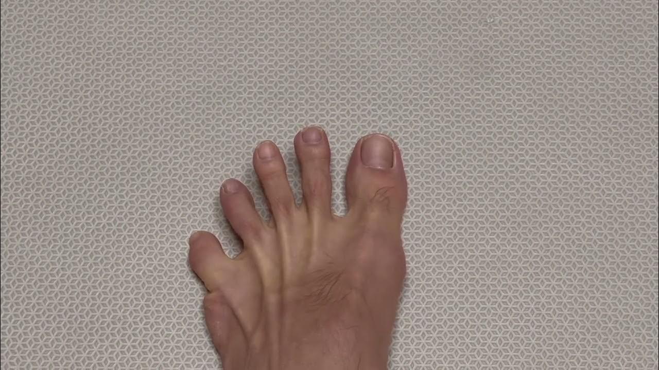 How to exercise "ToeSpreadout" YouTube