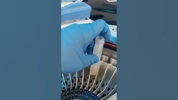 loading Reagent on turbochem magna #Lifelinediagnostics #bloodchemistry #clinicalchemistry #cls #mls