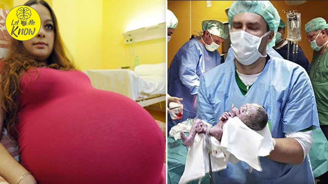 Doctors are beside themselves over historic pregnancy, only happens