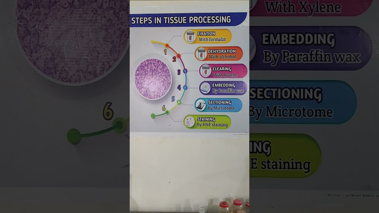 Steps in Tissue Processing