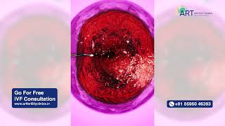IVF vs. Natural Pregnancy: Differences, Benefits, and Considerations | ART Fertility Clinics