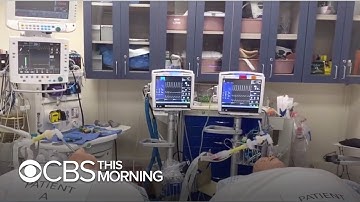 Team of doctors aims to create ventilator for multiple patients