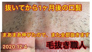 眠れぬ夜のヒゲ抜き動画 Plucking Facial Hair ずっと見ていられる熱中のヒゲ抜き 8 21 口元髭白髪密集 Pull Out The Beard 睡眠導入 毛抜き職人 Hair Removal Specialist 眠れぬ夜のヒゲ抜き動画 Plucking Facial Hair ずっと見ていられる熱中のヒゲ抜き 8 21 口元髭白髪密集 Pull Out The Beard 睡眠導入 毛抜き職人 Hair Removal Specialist