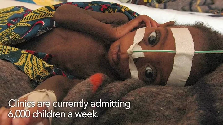 Sahel A Crisis of Food Security and Malnutrition