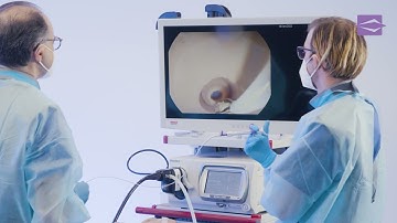 ERCP - Stone Extraction using a Stone Extraction Basket - EndoFlex GmbH - EN