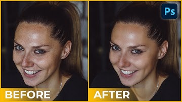 Fastest way to clean your face in photoshop | Remove pimples, blemishes, acne easily #trending