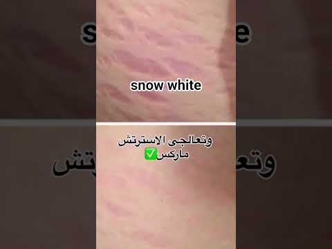 فوائد العناية بالبشرة من منتجات سنو وايت اكسبلور تجميل ترند تنعيم تيك توك لايك كيراتين تفتيح