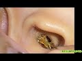 ASMR一度見たら忘れられない耳かきの世界