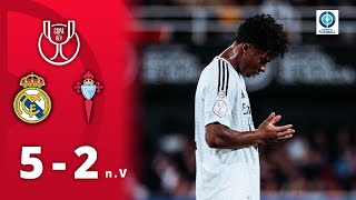 Thumbnail for Endrick per Hacke, Valverde traumhaft: Joker brillieren bei Pokal-Drama | Real Madrid - Celta Vigo