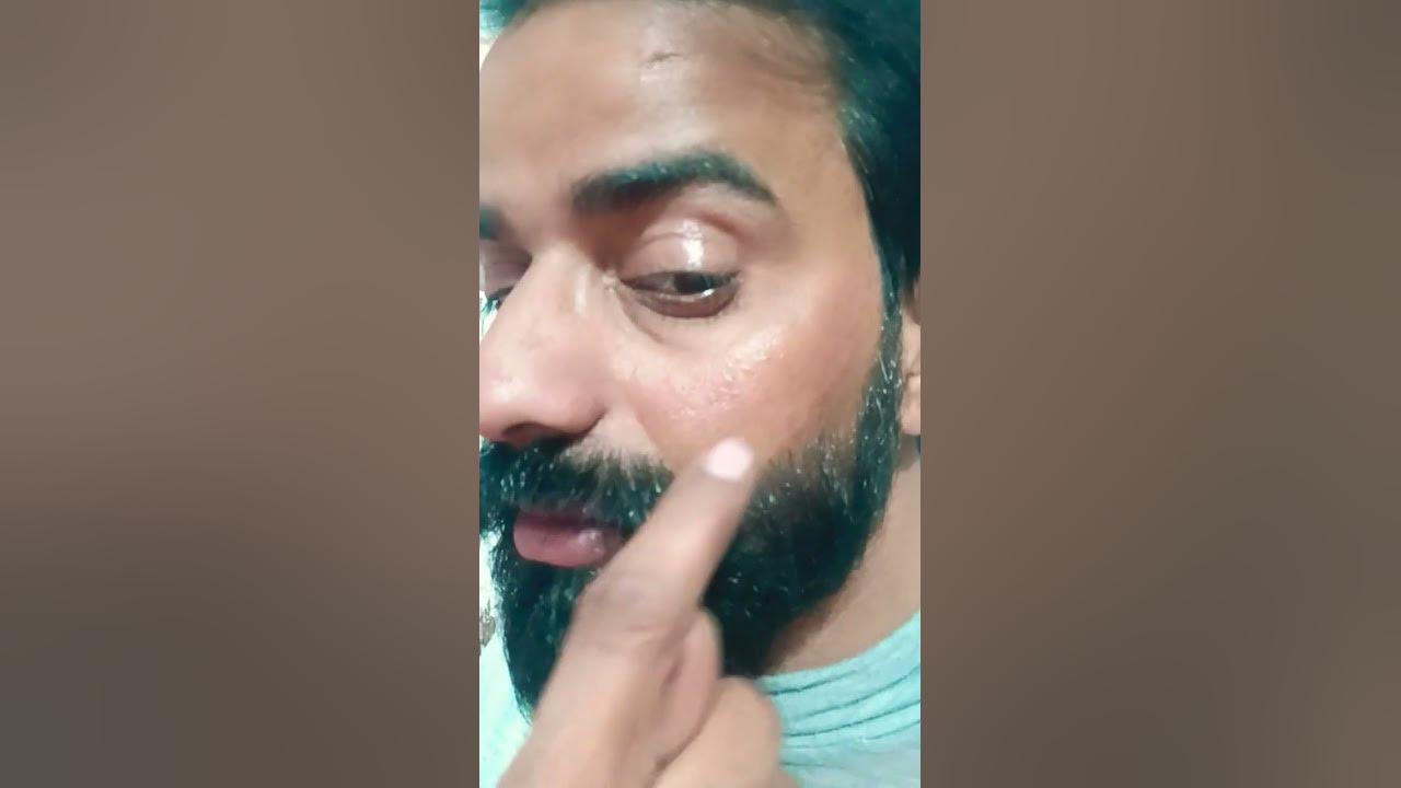 Hair Remove Laser..shorts short viral YouTube