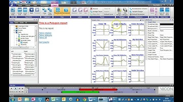 Making attractive gait graphs in Polygon