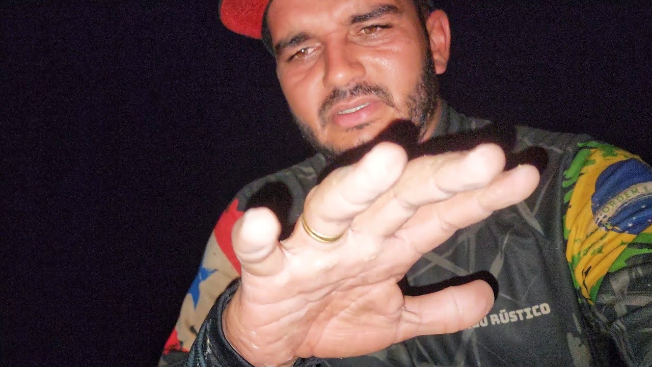 O PIOR ESTAVA POR VIR, QUASE M0RRI APOS A TEMPESTADE, REAÇÃO ALÉRGICA DA PICADA DOS MARIMBONDOS