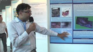 Surface reconstruction from endoscopic image sequence