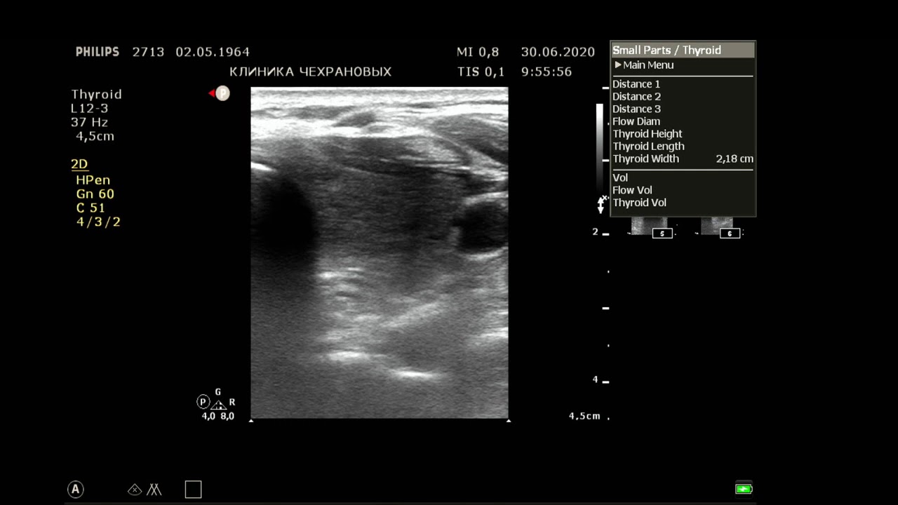 Обучение узи ultrasonicthyroid ru