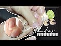 NAILS ♡ 8 remedios caseros para uñas quebradizas | MenaBlomster
