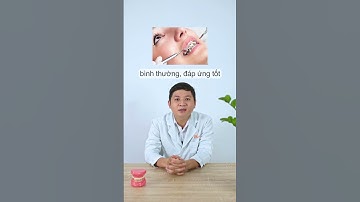 Hơn 30 tuổi niềng răng được không?