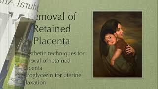 Practice Guidelines for Obstetric Anesthesia