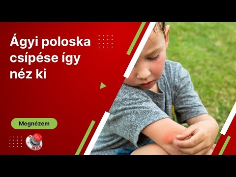 Videó: Isztambul fürdőházak: egy lépésről-lépésre útmutató