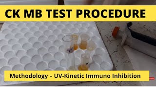 CK MB Procedure | Test for estimation of CK-MB activity in serum