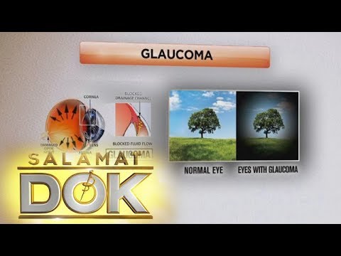 Video: 3 Mga paraan upang Magamot ang Glaucoma