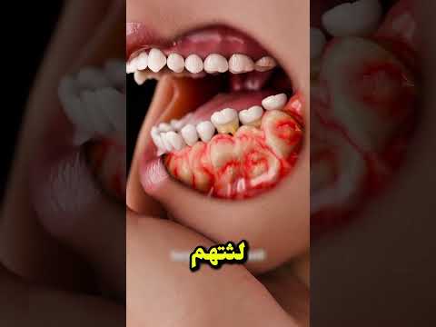 أسرار مرض فك الفسفور   