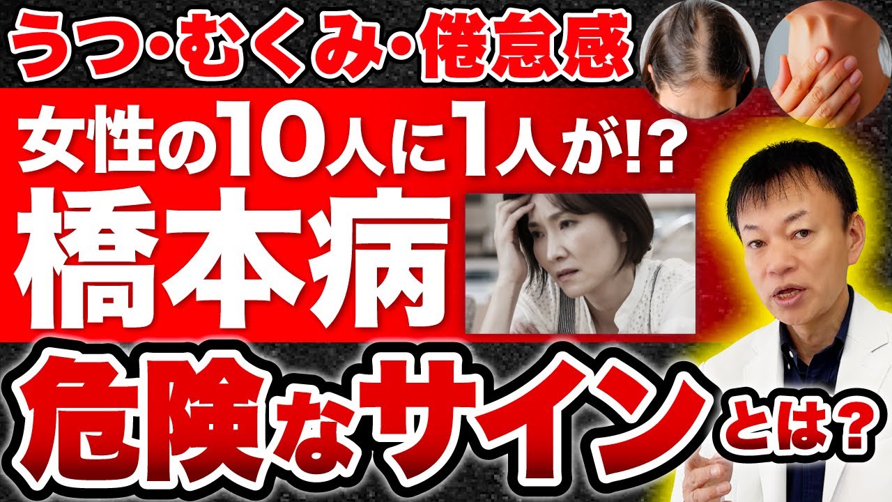 【むくみ・便秘・だるさ】知らないと必ず損する「女性の10人に1人がなる」橋本病の意外なサインと対策法について