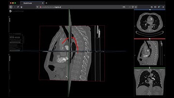 Vessel Centerline Calculation