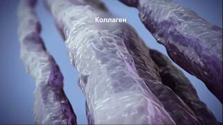 Как работает ультразвуковой лифтинг Ulthera System (Альтера)? Как работает ультразвуковой лифтинг Ulthera System (Альтера)?