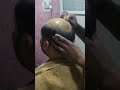 Hair Patch Fixing in Silicon(Glue) Process ......Full Process Step by Step Explaination..