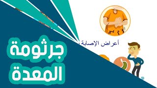 كل ما تريد معرفته عن الجرثومة الحلزونية | علاج الجرثومة الحلزونية من الطبيعة