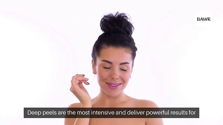 Chemical Peels for Hyperpigmentation in Dallas, TX: Smooth, Clear Skin