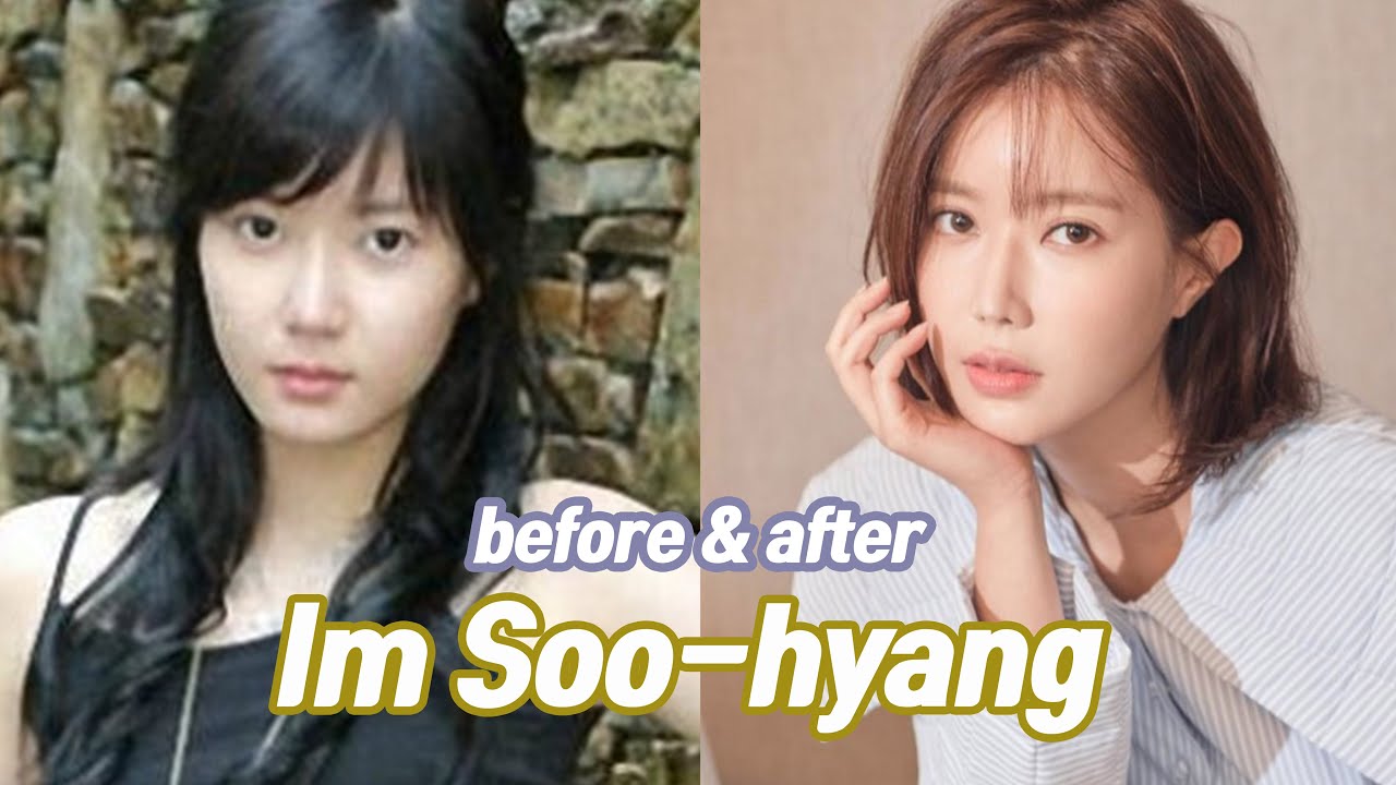 Im soo-hyang, 임수향, before, after, 전, 후, 전후, 성형, surgery.