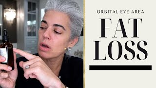 HOW I AM TREATING MY ORBITAL EYE AREA FAT LOSS | Nikol Johnson