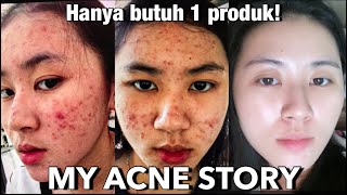 Skincare Routine untuk Ibu Hamil Pake Brand Lokal Semua!