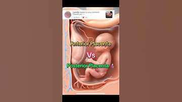 Anterior vs Posterior Placenta ♥️ #mothertobe #baby #pregnant #ultrasound #anteriorplacenta