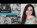 IMAGING OF ANTERIOR CRUCIATE LIGAMENTS | DR CHAITALI PAREKH | MRI KNEE | SEGONDS FRACTURE | ACL TEAR