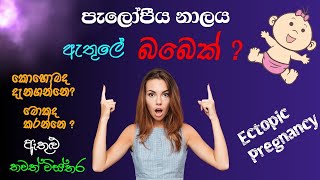 ගරභශයන පටත සදවන ගබ ගනම Ectopic Pregnancy Fallopian Tube Pregnancy In Sinhala