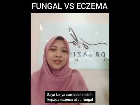 Video: Perbezaan Antara Ekzema Dan Dermatitis