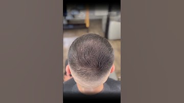 Thumbnail of Step-by-Step: Using Toppik Hair Fibers for Thinning Hair   #hairbuildingfibres #barbershop #toppik