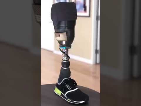 Amputee walking ' leg Amputee's triumph' walking Overcoming Adversity