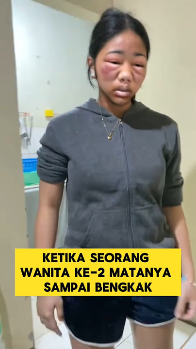 momen lucu ketika habis putus cinta banyak nangis mata sampai bengkak ‼️‼️ #ngakak #lucu #ketawa
