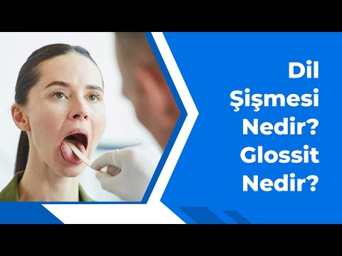 Video: Dil gecikmesinin şüpheli nedenleri nelerdir?