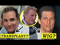 The Truth about Matthew McConaughey Hair Loss Reversal!