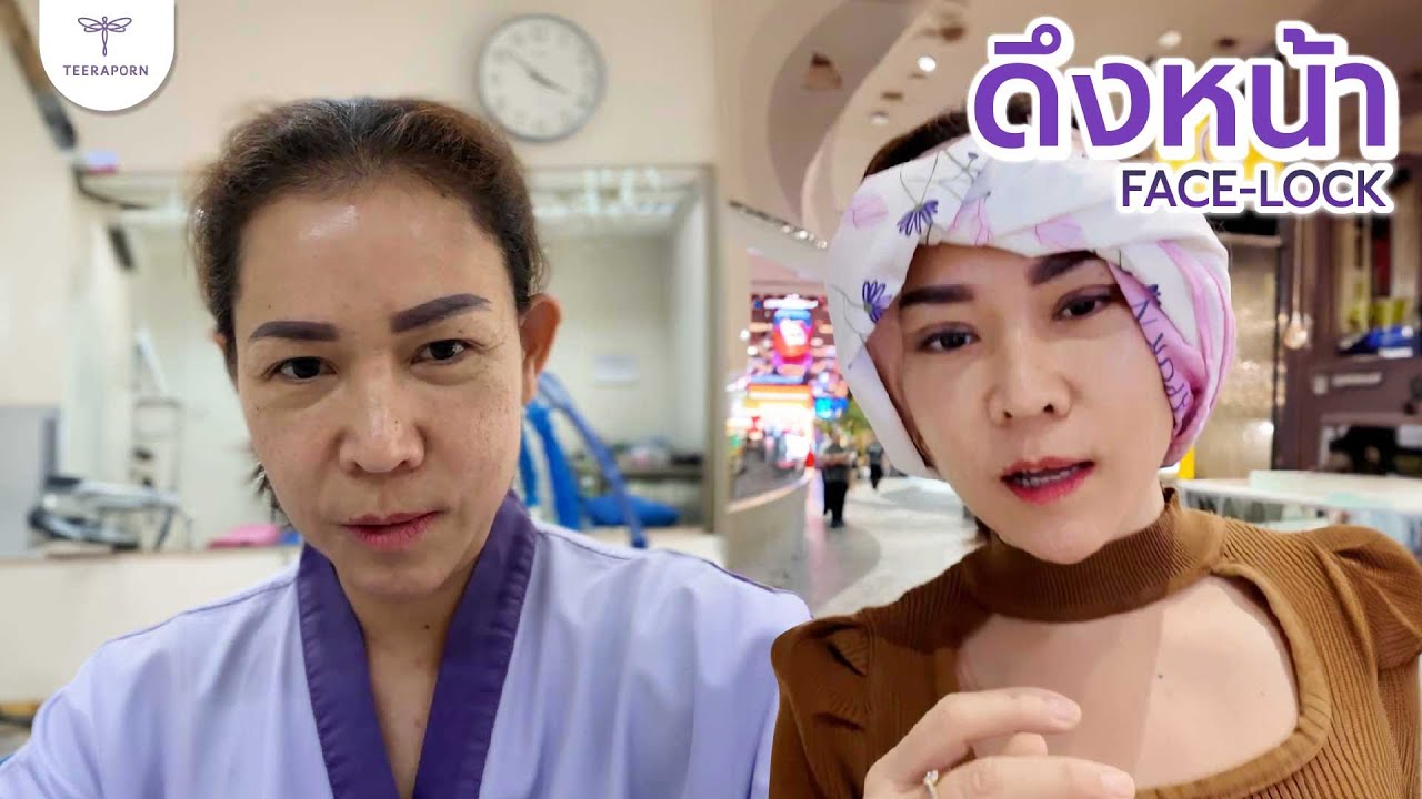 รักของแม่ไม่มีที่สิ้นสุด แต่มาหยุดที่ FACE-LOCK ธีรพรคลินิก หมอชลธิศ