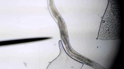 C. Elegans Wild Type