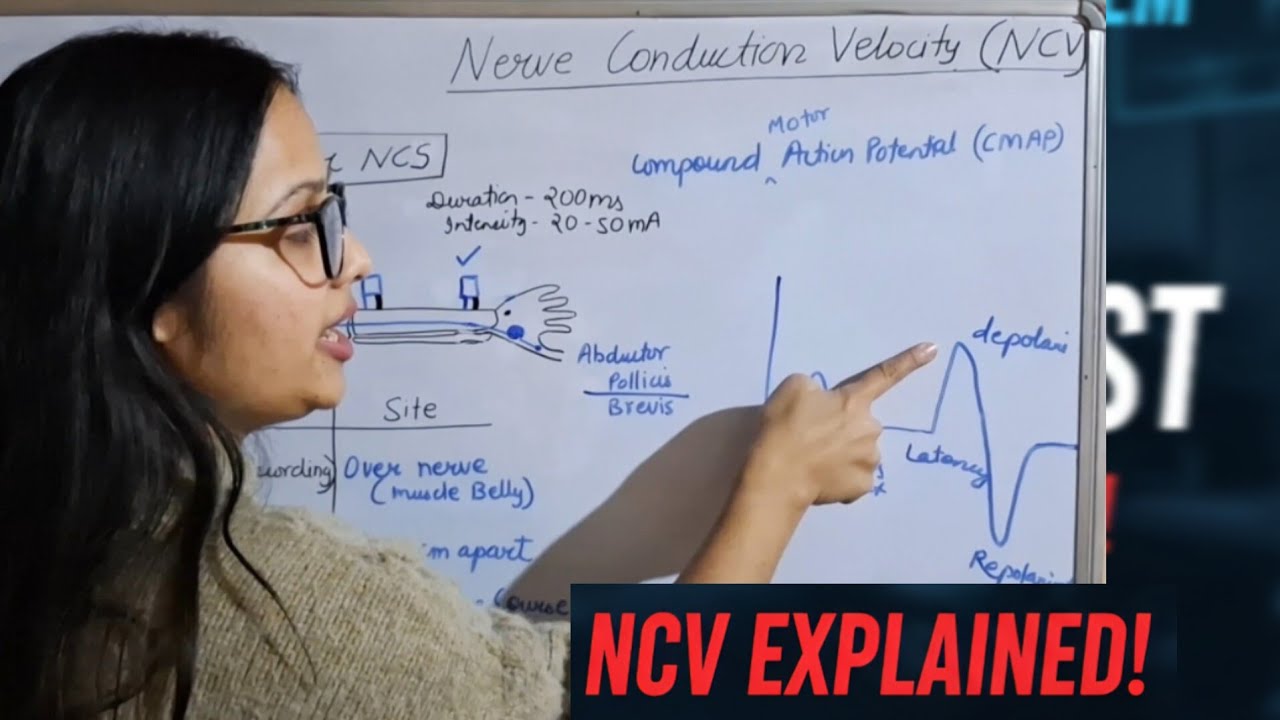 Ncva Rotation Tracker ( NCV )Nerve Conduction Velocity Test Explained || Motor & Sensory ...